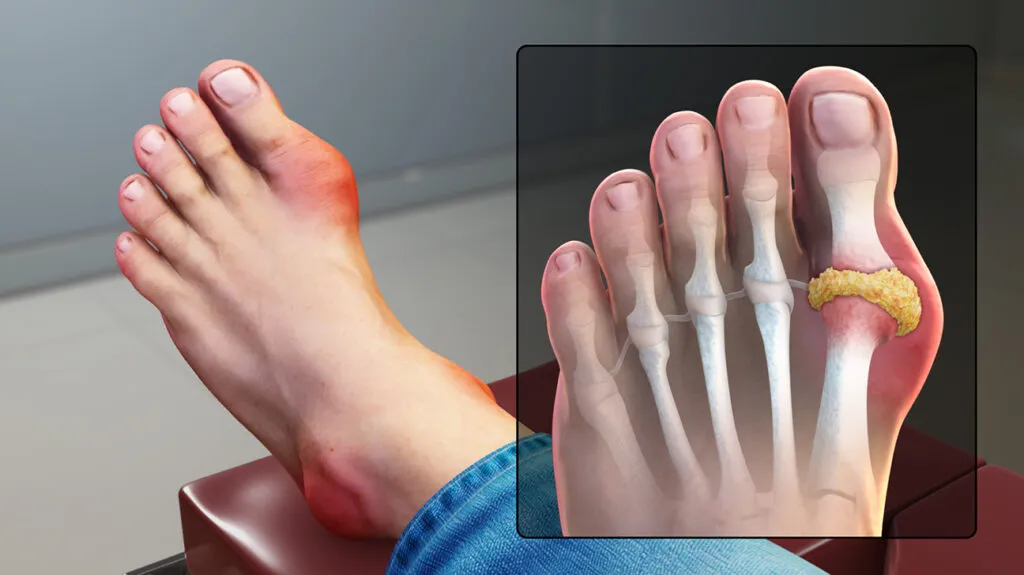 علت درد انگشتان پا در طب سنتی عوارض
